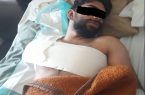 دست کارگر بروجردی از بازو قطع شد