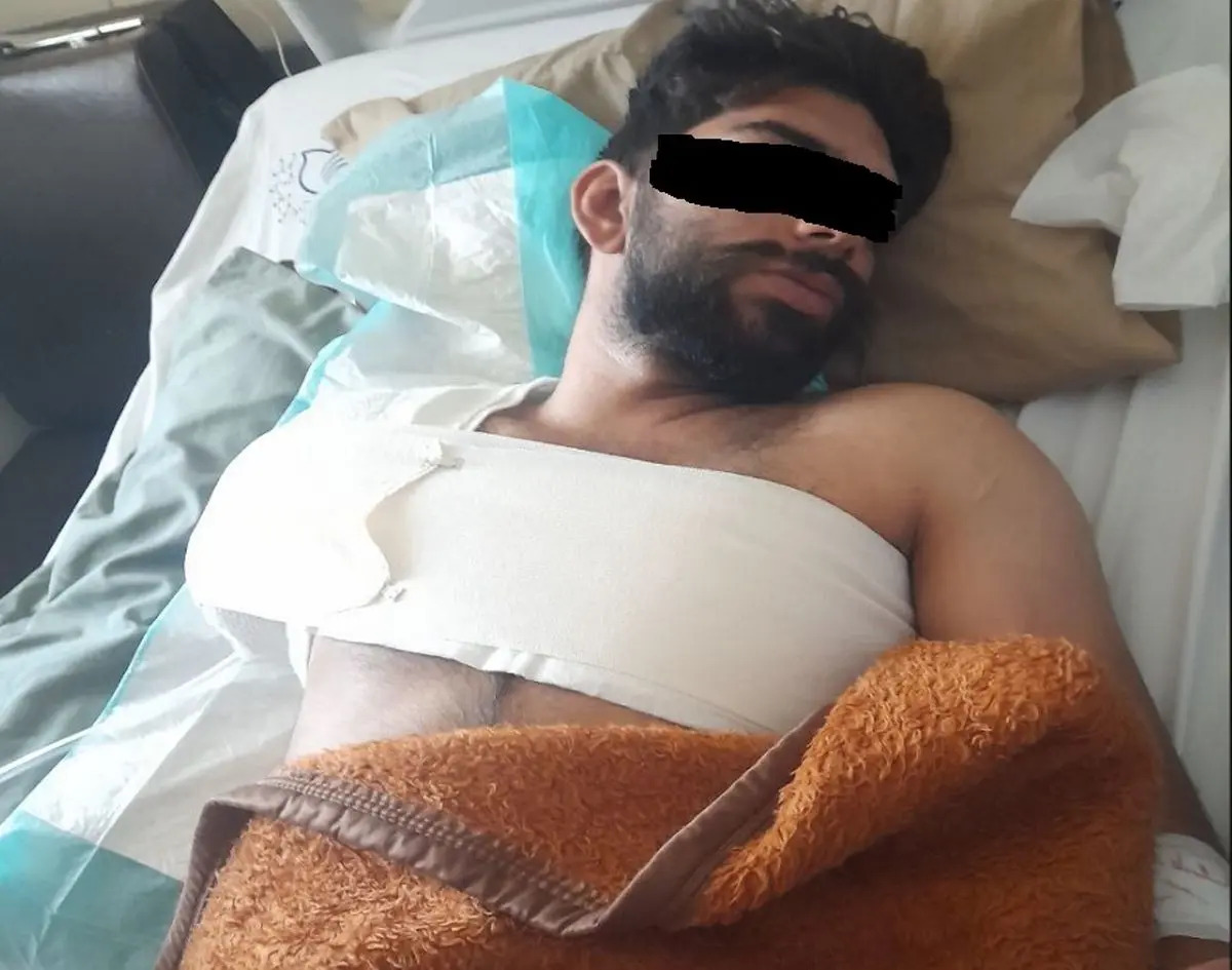دست کارگر بروجردی از بازو قطع شد